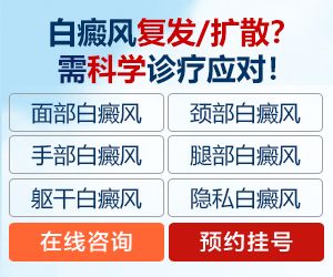 武威哪里有治疗白癜风的医院？如何科学的治疗白癜风？