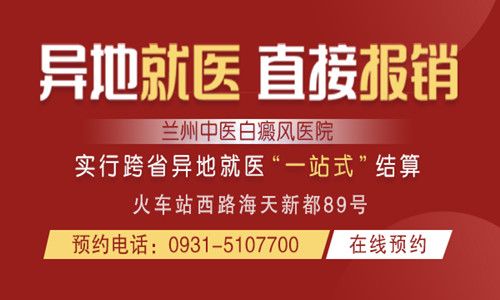 武威正规专业白癜风医院，如何避免白癜风的复发